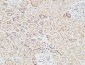Skp2 p45 Polyclonal Antibody
